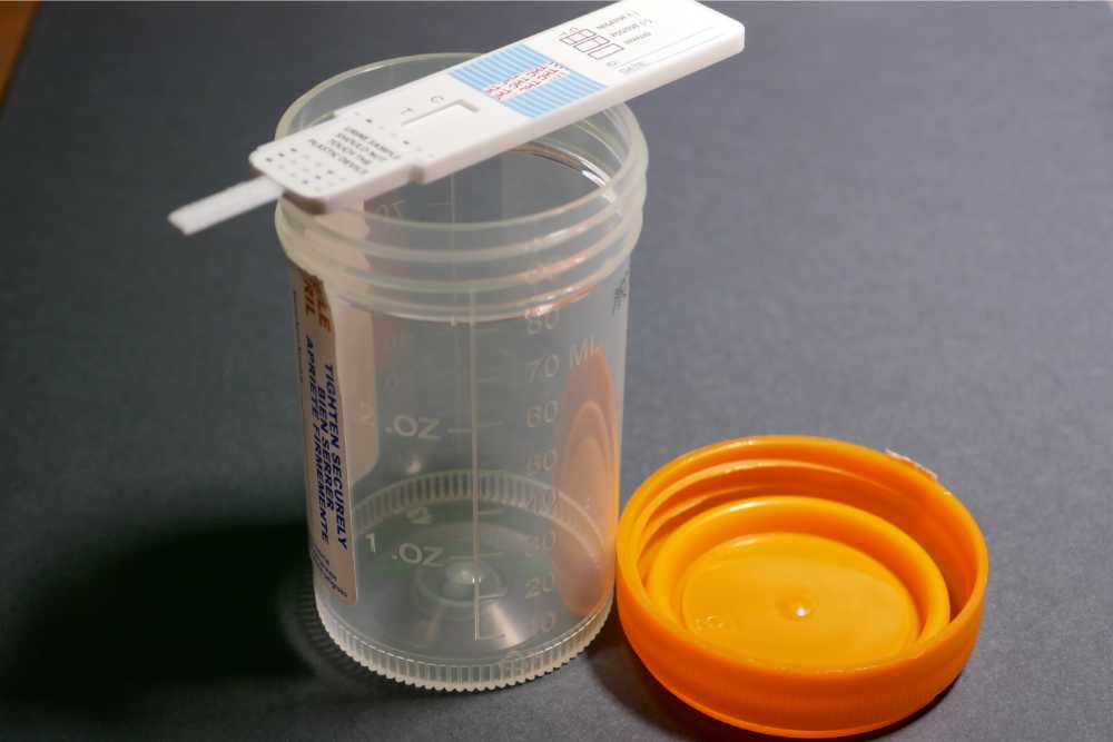 empty-urine-test-container-with-test-strip