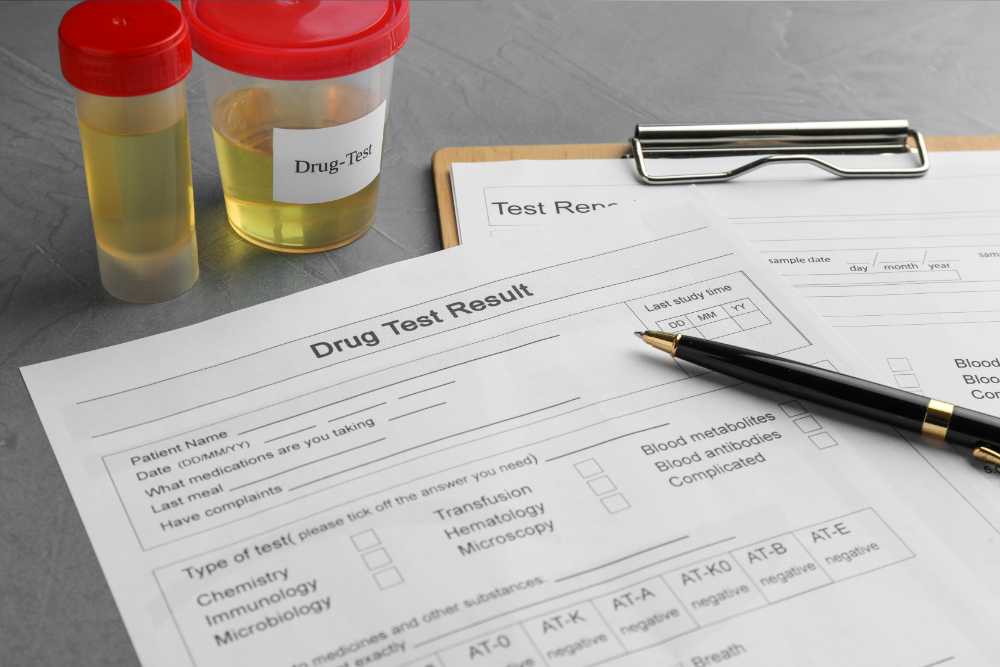 drug test with urine sample