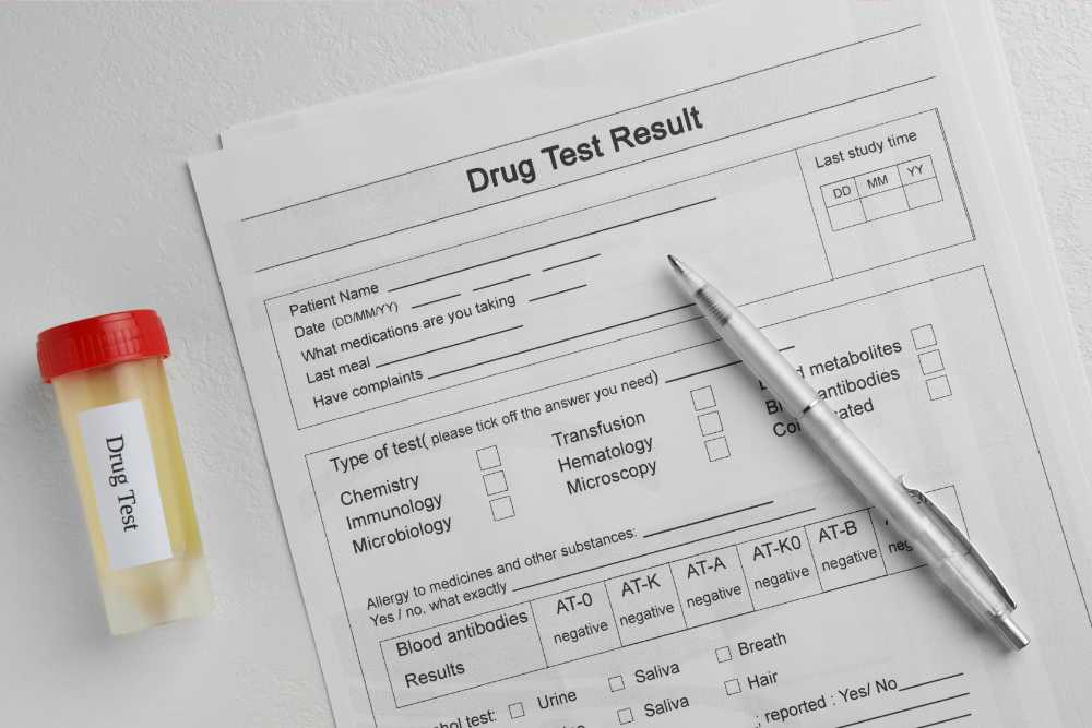 drug test fill out form with urine sample