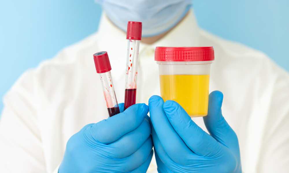 doctor with blue gloves holding blood and urine tests